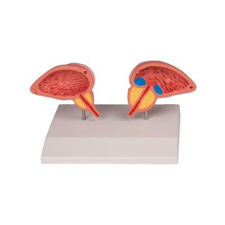 Model prostaty, dvoudílný
