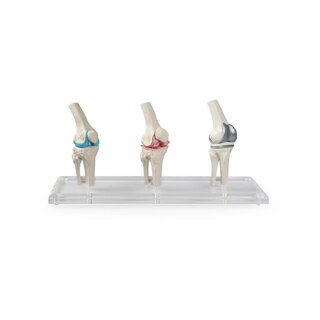 Model kolenního implantátu