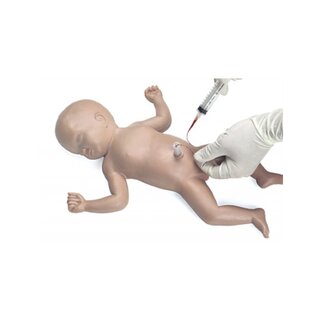 Zavedení pupečního katétru Baby Umbi