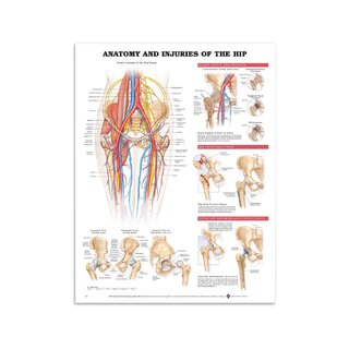Plakát - Anatomie a poranění kyčelního kloubu v angličtině
