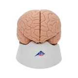 Klasické odlévání mozku