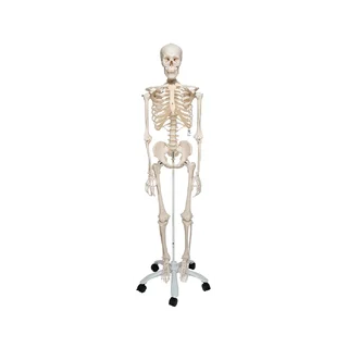 Extra robustní model kostry