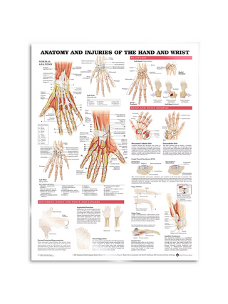 Plakát - Anatomie a patologie ruky a zápěstí